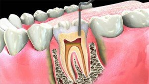 Rosetti Dent - clinica stomatologica